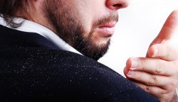 Как бороться с перхотью в домашних условиях? Как бороться с перхотью в домашних условиях?